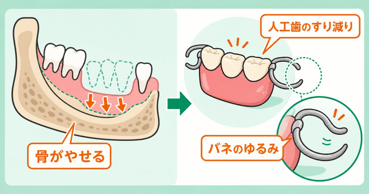 入れ歯が急にグラつく主な原因｜口内の変化と装置の劣化