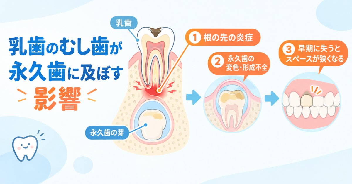 永久歯に影響が及ぶしくみ―変色・形成不全・歯並びの乱れ