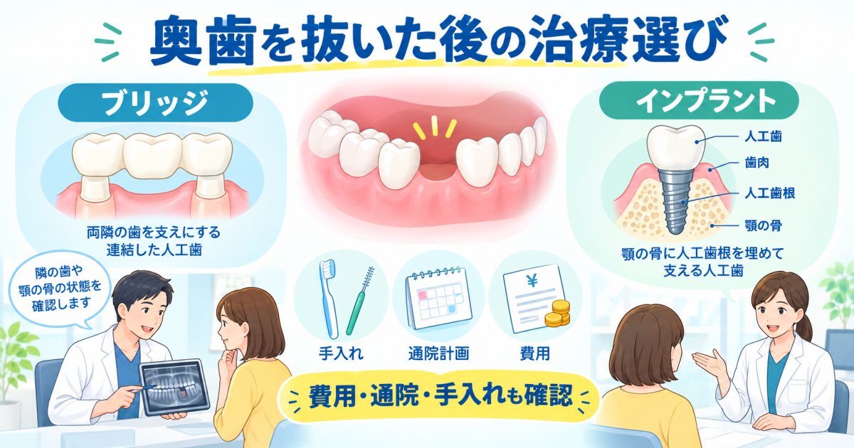 奥歯を抜歯した後、隣の歯が気になる方へ｜ブリッジとインプラントの違い