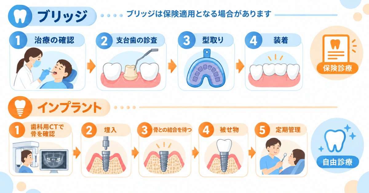 ブリッジとインプラント、抜歯後の進め方と費用の違い