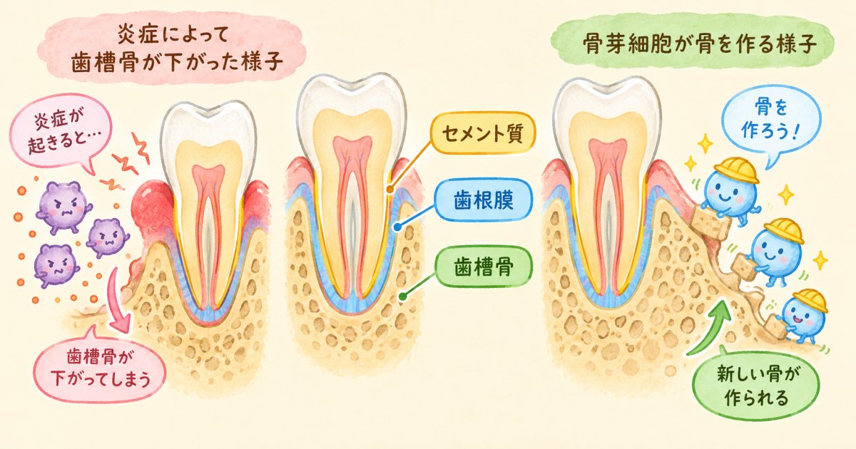 歯周病で減った歯槽骨は、どう再生されるのか